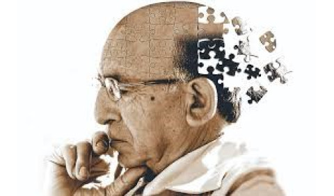 7 dicas para evitar a doença de Alzheimer